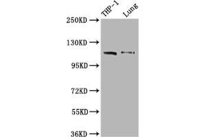Western Blot Positive WB detected in: THP-1 whole cell lysate, Mouse lung tissue All lanes: MDA5 antibody at 1:2000 Secondary Goat polyclonal to rabbit IgG at 1/50000 dilution Predicted band size: 117, 26 kDa Observed band size: 117 kDa (Recombinant IFIH1 antibody)