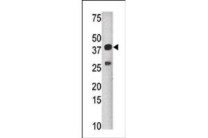 Image no. 1 for anti-Sulfotransferase Family, Cytosolic, 1C, Member 4 (SULT1C4) (N-Term) antibody (ABIN357817) (SULT1C4 antibody  (N-Term))