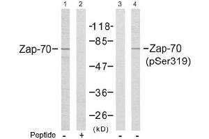 Image no. 2 for anti-zeta-Chain (TCR) Associated Protein Kinase 70kDa (ZAP70) (Tyr319) antibody (ABIN197384) (ZAP70 antibody  (Tyr319))