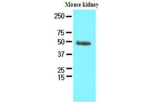 Western Blotting (WB) image for anti-Proteasome (Prosome, Macropain) 26S Subunit, Non-ATPase, 11 (PSMD11) (AA 1-422), (N-Term) antibody (ABIN371887) (PSMD11 antibody  (N-Term))