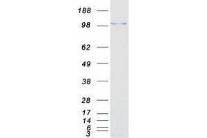 Validation with Western Blot (USP38 Protein (Myc-DYKDDDDK Tag))