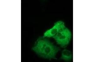 Anti-TACC3 mouse monoclonal antibody (ABIN2453830) immunofluorescent staining of COS7 cells transiently transfected by pCMV6-ENTRY TACC3 (RC210754). (TACC3 antibody)