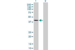 Western Blot analysis of IVD expression in transfected 293T cell line by IVD MaxPab polyclonal antibody. (IVD antibody  (AA 1-423))