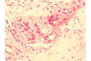 Human Myenteric Plexus Ganglion: Formalin-Fixed, Paraffin-Embedded (FFPE) (NPY2R antibody  (C-Term))