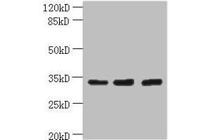 Western blot All lanes: OTUD6B antibody at 4 μg/mL Lane 1: PC-3 whole cell lysate Lane 2: 293T whole cell lysate Lane 3: MDA-MB-231 whole cell lysate Secondary Goat polyclonal to rabbit IgG at 1/10000 dilution Predicted band size: 34, 22 kDa Observed band size: 34 kDa