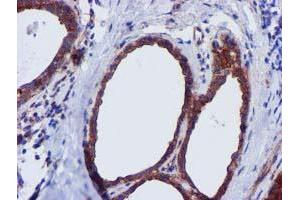 Immunohistochemical staining of paraffin-embedded Human breast tissue using anti-EPN2 mouse monoclonal antibody. (Epsin 2 antibody)