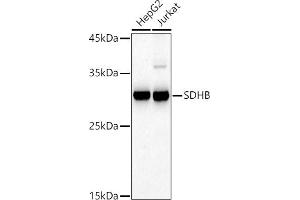 Western blot analysis of extracts of various cell lines, using SDHB antibody (ABIN6131588, ABIN6147472, ABIN6147474 and ABIN6215002) at 1:500 dilution. (SDHB antibody  (AA 29-280))