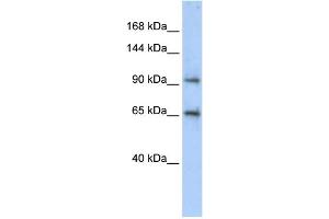 WB Suggested Anti-CCDC52 Antibody Titration: 0. (SPICE1 antibody  (Middle Region))