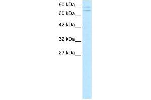 ZNF81 antibody (20R-1073) used at 0. (ZNF81 antibody  (Middle Region))