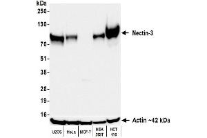 Western Blotting (WB) image for anti-Nectin cell adhesion molecule 3 (NECTIN3) (AA 58-400) antibody (ABIN7795718)
