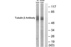 Western blot analysis of extracts from rat brain and mouse brain cells, using Tubulin beta antibody.