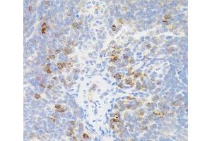 Immunohistochemistry of paraffin-embedded Mouse spleen using TNFRSF13B Polyclonal Antibody at dilution of 1:100 (40x lens). (TACI antibody)
