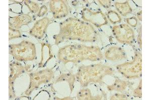 Immunohistochemistry of paraffin-embedded human kidney tissue using ABIN7143208 at dilution of 1:100 (ACBD4 antibody  (AA 1-305))