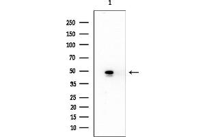 Western blot analysis of lysates from EC304 cells, using TFG Mouse Monoclonal Antibody at 1/1000 dilution.