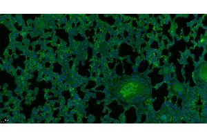 Paraformaldehyde-fixed, paraffin embedded rat lung, Antigen retrieval by boiling in sodium citrate buffer (pH6) for 15min, Block endogenous peroxidase by 3% hydrogen peroxide for 30 minutes,  Blocking buffer (normal goat serum) at 37°C for 20min, Antibody incubation with Alpha Glucosidase Polyclonal Antibody (bs-13254R) at 1:200 overnight at 4°C, followed by a conjugated secondary. (GAA antibody  (AA 541-640))