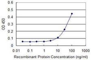Detection limit for recombinant GST tagged ZAK is approximately 10ng/ml as a capture antibody. (ZAK antibody  (AA 1-455))