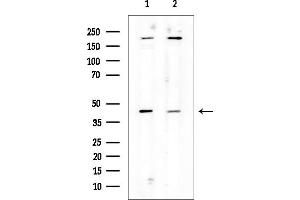 Western blot analysis of lysates from various samples, using Aurora A Mouse Monoclonal Antibody.
