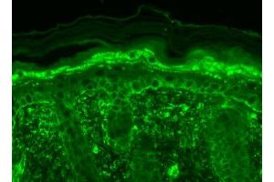 Immunohistochemistry analysis using Mouse Anti-TrpV3 Monoclonal Antibody, Clone S15-39 . (TRPV3 antibody  (AA 458-474) (PerCP))