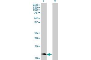 CCL1 antibody  (AA 1-96)