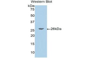 Western Blotting (WB) image for anti-Jagged 1 (JAG1) (AA 33-250) antibody (ABIN1175042) (JAG1 antibody  (AA 33-250))