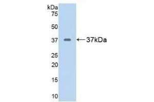 Detection of Recombinant ARG, Rat using Polyclonal Antibody to Arginase (ARG) (ARG antibody  (AA 1-323))