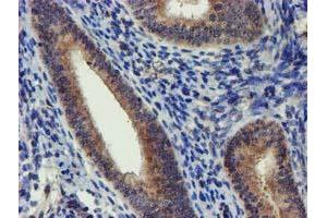 Immunohistochemical staining of paraffin-embedded Human endometrium tissue using anti-DCLRE1B mouse monoclonal antibody.