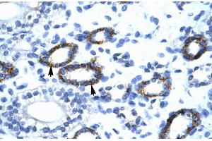 Human kidney; GTF2F2 antibody - C-terminal region in Human kidney cells using Immunohistochemistry (GTF2F2 antibody  (C-Term))