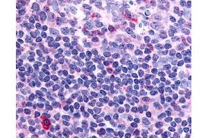 Anti-Thrombin Receptor antibody IHC of human tonsil. (PAR1 antibody  (N-Term))
