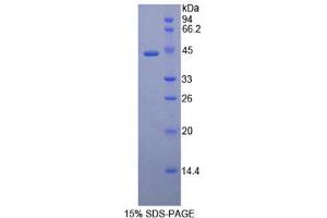 SDS-PAGE (SDS) image for Platelet-Derived Growth Factor C (PDGFC) (AA 23-345) protein (His tag) (ABIN1879310) (PDGFC Protein (AA 23-345) (His tag))