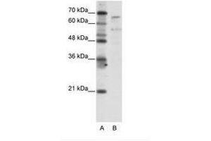 Image no. 1 for anti-TAF6-Like RNA Polymerase II, P300/CBP-Associated Factor (PCAF)-Associated Factor, 65kDa (TAF6L) (N-Term) antibody (ABIN203282) (TAF6L antibody  (N-Term))