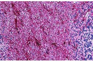Human Brain, Cerebellum: Formalin-Fixed, Paraffin-Embedded (FFPE)