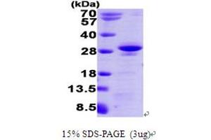 SDS-PAGE (SDS) image for R-Ras (AA 1-215) protein (His tag) (ABIN667781) (R-Ras Protein (AA 1-215) (His tag))