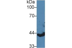 Western blot analysis of Pig Spleen lysate, using Human KRT13 Antibody (5 µg/ml) and HRP-conjugated Goat Anti-Rabbit antibody ( (Cytokeratin 13 antibody  (AA 104-403))