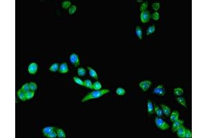 Immunofluorescent analysis of PC-3 cells using ABIN7158756 at dilution of 1:100 and Alexa Fluor 488-congugated AffiniPure Goat Anti-Rabbit IgG(H+L) (LYPLAL1 antibody  (AA 2-237))