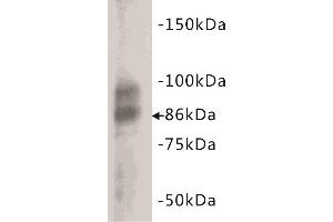 Western Blotting (WB) image for anti-Glycoprotein Hormones, alpha Polypeptide (CGA) (C-Term) antibody (ABIN1854868) (CGA antibody  (C-Term))