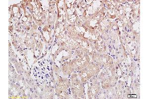 Formalin-fixed and paraffin embedded rat kidney tissue labeled with Anti ST2 Polyclonal Antibody, Unconjugated (ABIN680243) at 1:200 followed by conjugation to the secondary antibody and DAB staining