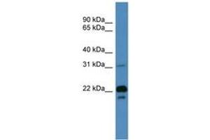Image no. 1 for anti-Brain Abundant, Membrane Attached Signal Protein 1 (BASP1) (AA 51-100) antibody (ABIN6746712) (BASP1 antibody  (AA 51-100))