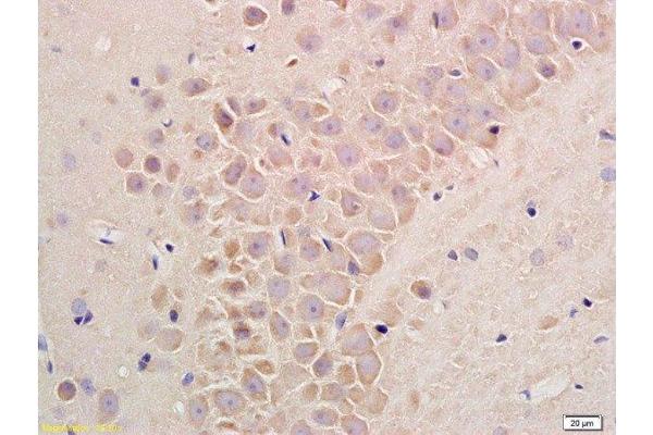 Substance P antibody  (AA 58-68)