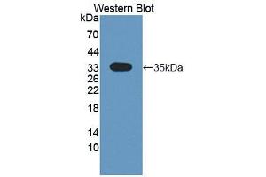Western blot analysis of the recombinant protein. (CMTM1 antibody  (AA 1-286))