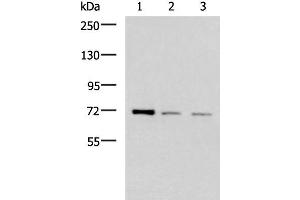 Western blot analysis of K562 HepG2 and Jurkat cell lysates using FOXK1 Polyclonal Antibody at dilution of 1:400 (Foxk1 antibody)