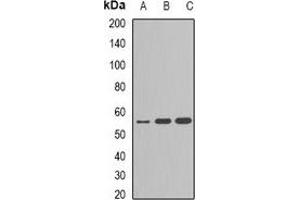 Western blot analysis of Cytochrome P450 2C9 expression in A549 (A), MCF7 (B), HepG2 (C) whole cell lysates. (CYP2C9 antibody)