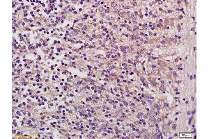 Formalin-fixed and paraffin embedded mouse embryo labeled with Anti GUSB/beta glucuronidase Polyclonal Antibody, Unconjugated (ABIN873149) at 1:200 followed by conjugation to the secondary antibody and DAB staining (Glucuronidase beta antibody  (AA 589-651))