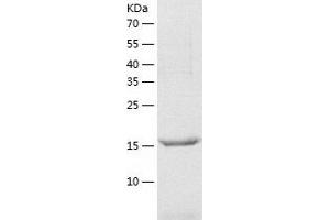 Western Blotting (WB) image for Josephin Domain Containing 1 (JOSD1) (AA 1-202) protein (His tag) (ABIN7287250) (JOSD1 Protein (AA 1-202) (His tag))