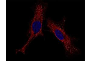 Indirect immunostaining of HELA cells (dilution 1 : 100; red). (Syntaxin 4 antibody  (Cytoplasmic Domain))