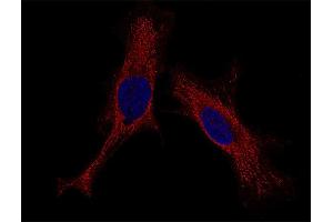 Indirect immunostaining of HELA cells (dilution 1 : 100; red).