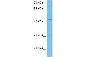 Host:  Rabbit  Target Name:  ETV4  Sample Tissue:  Human Jurkat Whole Cell  Antibody Dilution:  1ug/ml (ETV4 antibody  (Middle Region))