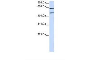 Image no. 1 for anti-Optineurin (OPTN) (AA 72-121) antibody (ABIN6737673) (OPTN antibody  (AA 72-121))