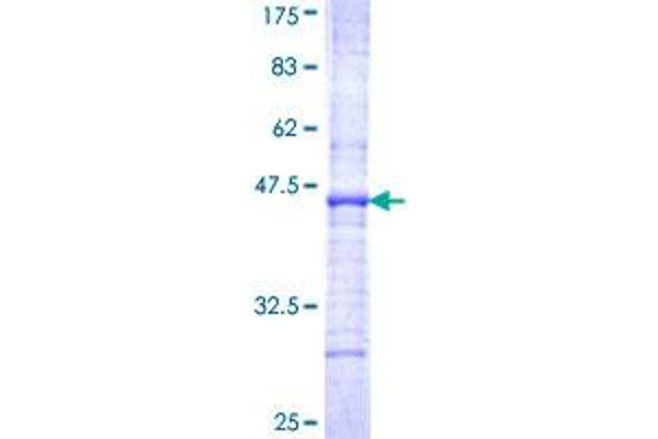 GHRHR Protein (AA 23-132) (GST tag)