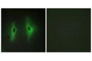 Immunofluorescence analysis of HeLa cells, using DGKH antibody. (DGKH antibody)