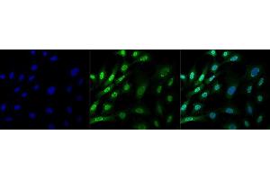 Immunocytochemistry/Immunofluorescence analysis using Mouse Anti-Ubiquitin Monoclonal Antibody, Clone FK1 (ABIN5024470). (Ubiquitin antibody  (FITC))